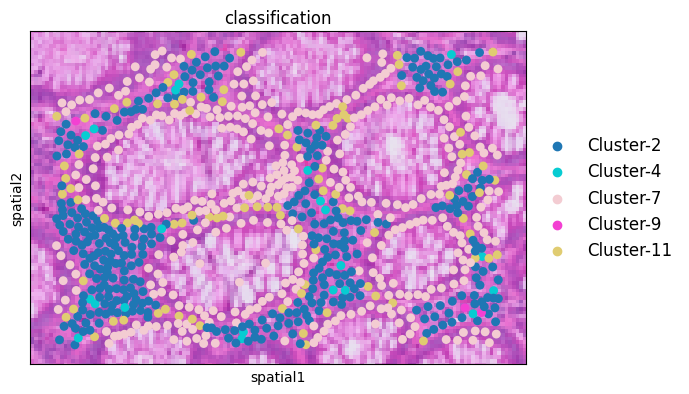../_images/notebooks_Colon_Cancer_demo_10_1.png