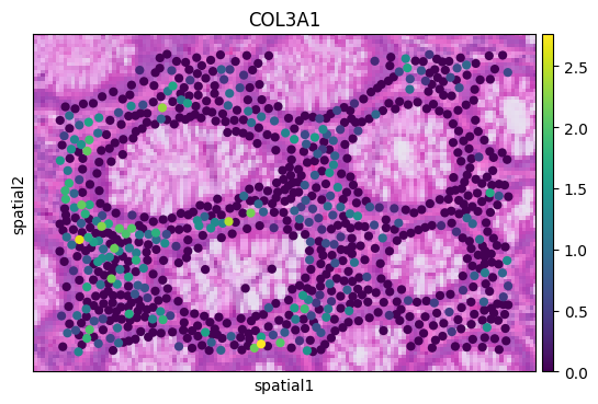 ../_images/notebooks_Colon_Cancer_demo_11_1.png