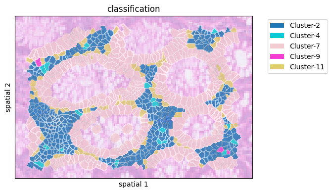 ../_images/notebooks_Colon_Cancer_demo_13_0.png