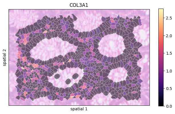 ../_images/notebooks_Colon_Cancer_demo_14_0.png