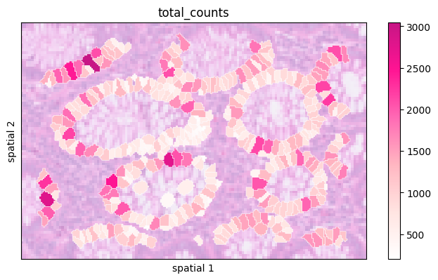 ../_images/notebooks_Colon_Cancer_demo_16_0.png