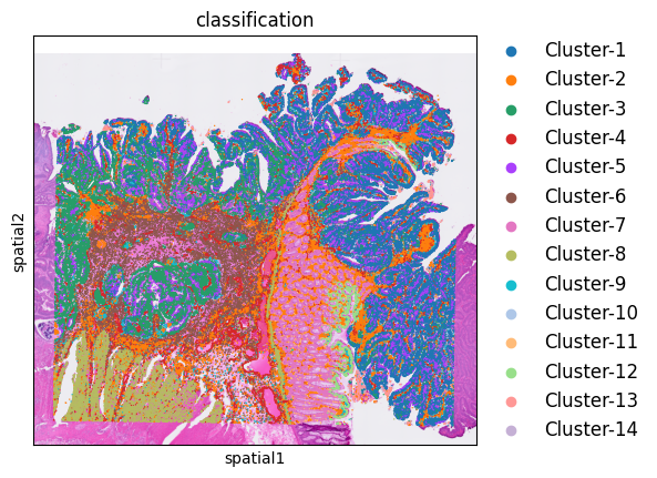 ../_images/notebooks_Colon_Cancer_demo_5_1.png